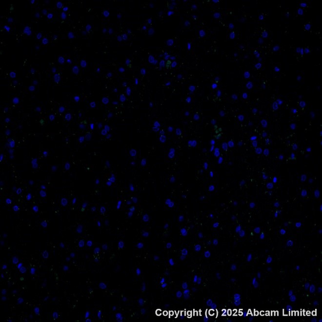 Alexa Fluor 488 Anti-E Cadherin antibody [EP700Y] - Intercellular Junction Marker