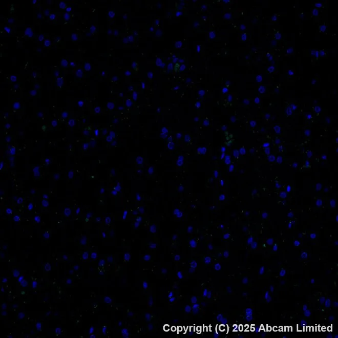 Immunohistochemistry (Formalin/PFA-fixed paraffin-embedded sections) - Alexa Fluor® 488 Anti-E Cadherin antibody [EP700Y] - Intercellular Junction Marker (AB185013)