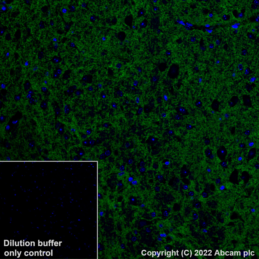 Immunohistochemistry (Formalin/PFA-fixed paraffin-embedded sections) - Alexa Fluor® 488 Anti-EAAT2 antibody [EPR19798] (ab313818), expandable thumbnail