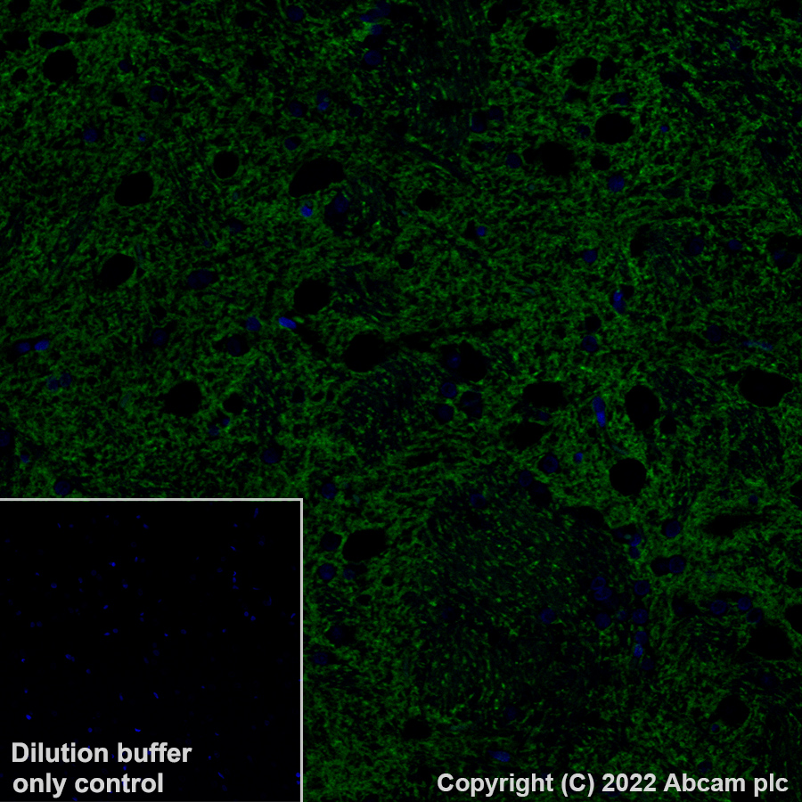 Immunohistochemistry (Formalin/PFA-fixed paraffin-embedded sections) - Alexa Fluor® 488 Anti-EAAT2 antibody [EPR19798] (AB313818), expandable thumbnail