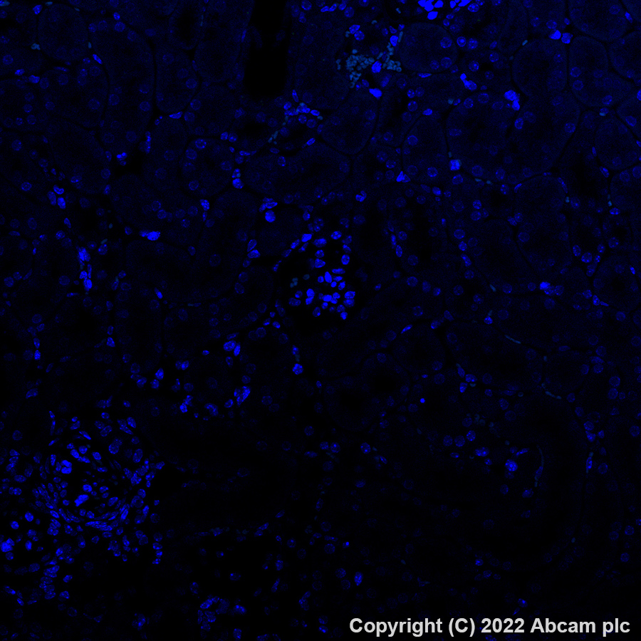 Immunohistochemistry (Formalin/PFA-fixed paraffin-embedded sections) - Alexa Fluor® 488 Anti-EAAT2 antibody [EPR19798] (AB313818), expandable thumbnail