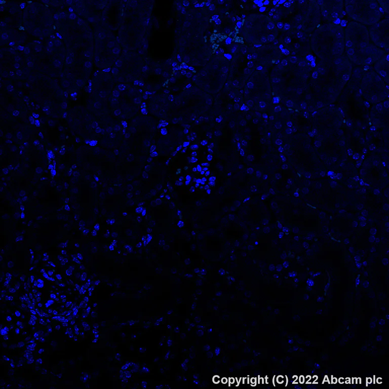 Immunohistochemistry (Formalin/PFA-fixed paraffin-embedded sections) - Alexa Fluor® 488 Anti-EAAT2 antibody [EPR19798] (AB313818)