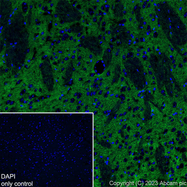 Immunohistochemistry (Frozen sections) - Alexa Fluor® 488 Anti-EAAT2 antibody [EPR19798] (AB313818), expandable thumbnail