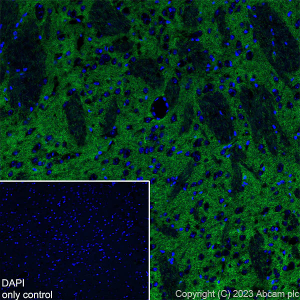 Immunohistochemistry (Frozen sections) - Alexa Fluor® 488 Anti-EAAT2 antibody [EPR19798] (AB313818)