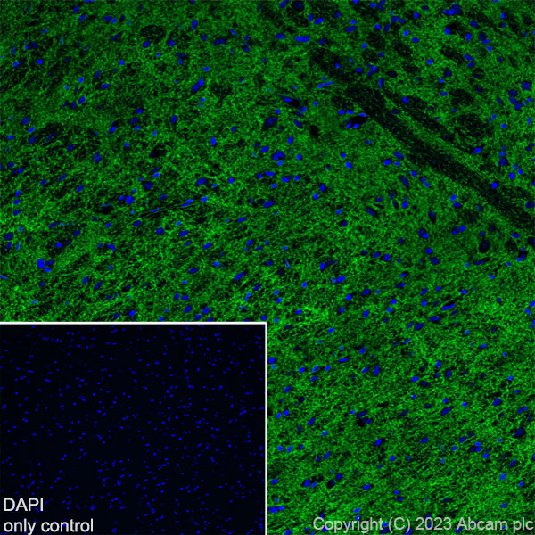 Immunohistochemistry (Frozen sections) - Alexa Fluor® 488 Anti-EAAT2 antibody [EPR19798] (AB313818), expandable thumbnail