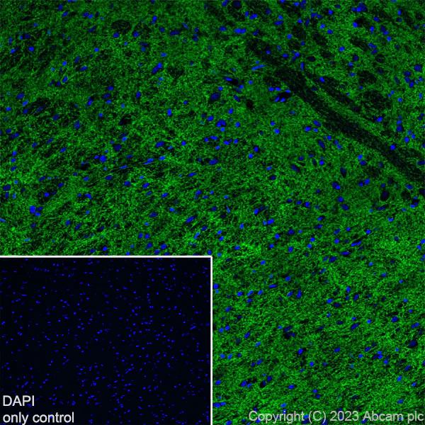 Immunohistochemistry (Frozen sections) - Alexa Fluor® 488 Anti-EAAT2 antibody [EPR19798] (AB313818)