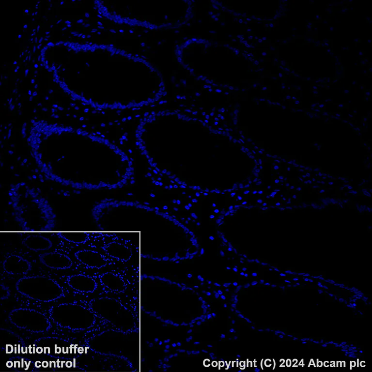 Immunohistochemistry (Formalin/PFA-fixed paraffin-embedded sections) - Alexa Fluor® 488 Anti-EBI3 antibody [EPR23372-282] (AB318239)
