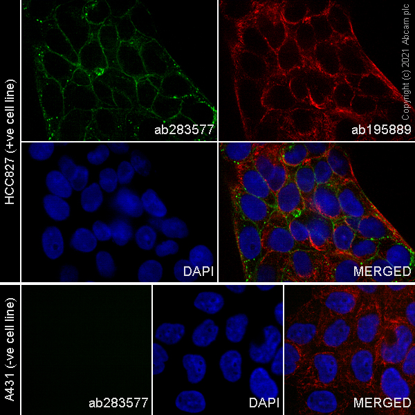 Immunocytochemistry/ Immunofluorescence - Alexa Fluor® 488 Anti-EGFR (deleted E746 + L747 + R748 + E749 + A750) antibody [SP111] (AB283577)