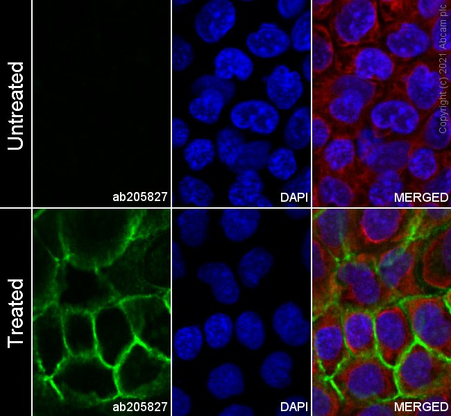 Immunocytochemistry/ Immunofluorescence - Alexa Fluor® 488 Anti-EGFR (phospho Y1068) antibody [EP774Y] (AB205827), expandable thumbnail