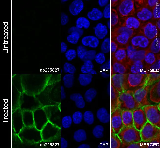 Immunocytochemistry/ Immunofluorescence - Alexa Fluor® 488 Anti-EGFR (phospho Y1068) antibody [EP774Y] (AB205827)