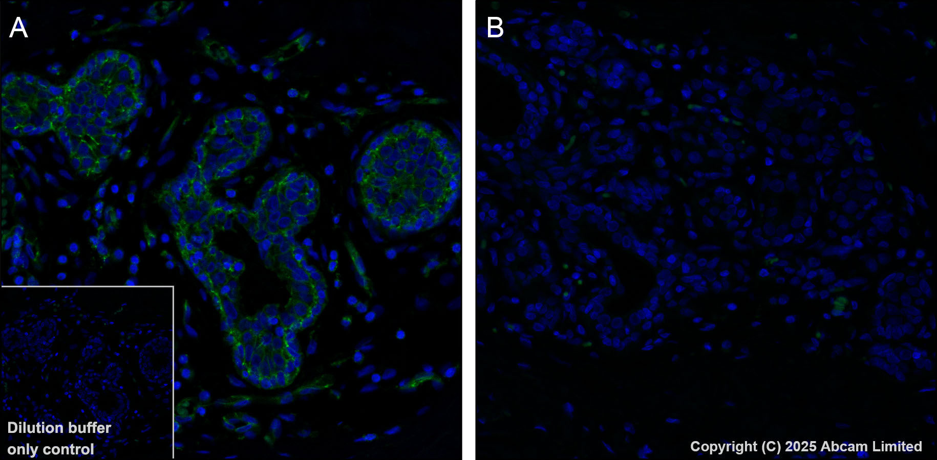 Immunohistochemistry (Formalin/PFA-fixed paraffin-embedded sections) - Alexa Fluor® 488 Anti-EGFR (phospho Y1068) antibody [EP774Y] (AB205827), expandable thumbnail
