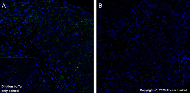 Immunohistochemistry (Formalin/PFA-fixed paraffin-embedded sections) - Alexa Fluor® 488 Anti-EGFR (phospho Y1068) antibody [EP774Y] (AB205827)