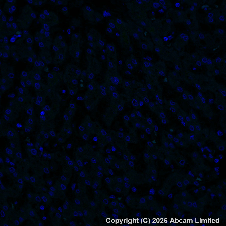 Immunohistochemistry (Formalin/PFA-fixed paraffin-embedded sections) - Alexa Fluor® 488 Anti-EGFR (phospho Y1068) antibody [EP774Y] (AB205827), expandable thumbnail