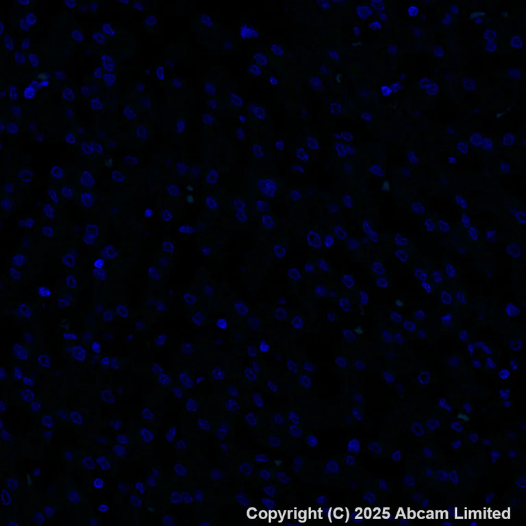 Immunohistochemistry (Formalin/PFA-fixed paraffin-embedded sections) - Alexa Fluor® 488 Anti-EGFR (phospho Y1068) antibody [EP774Y] (AB205827)