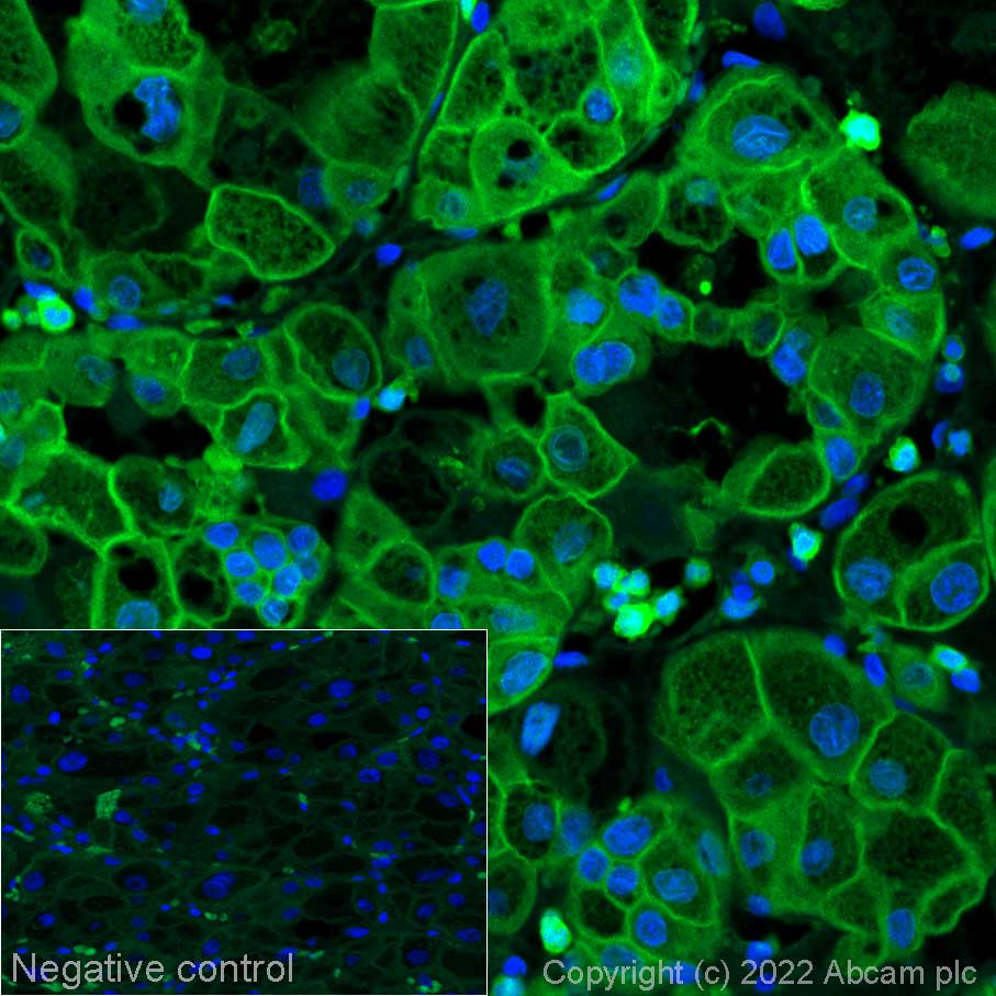 Immunohistochemistry (Formalin/PFA-fixed paraffin-embedded sections) - Alexa Fluor® 488 Anti-ENO1 antibody [EPR19758] (AB303582)