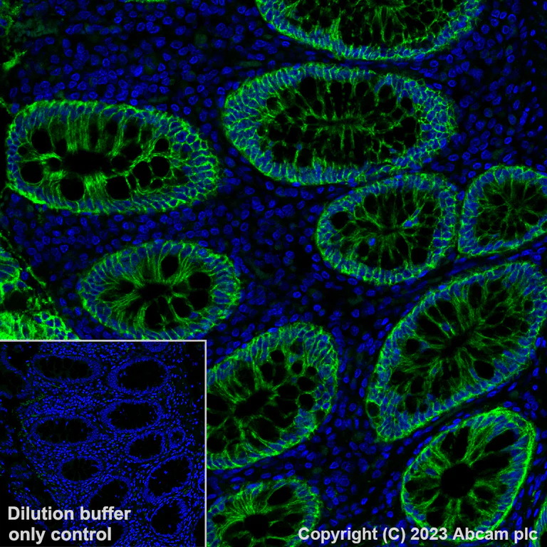 Immunohistochemistry (Formalin/PFA-fixed paraffin-embedded sections) - Alexa Fluor® 488 Anti-EpCAM antibody [EPR20532-222] (AB313667)