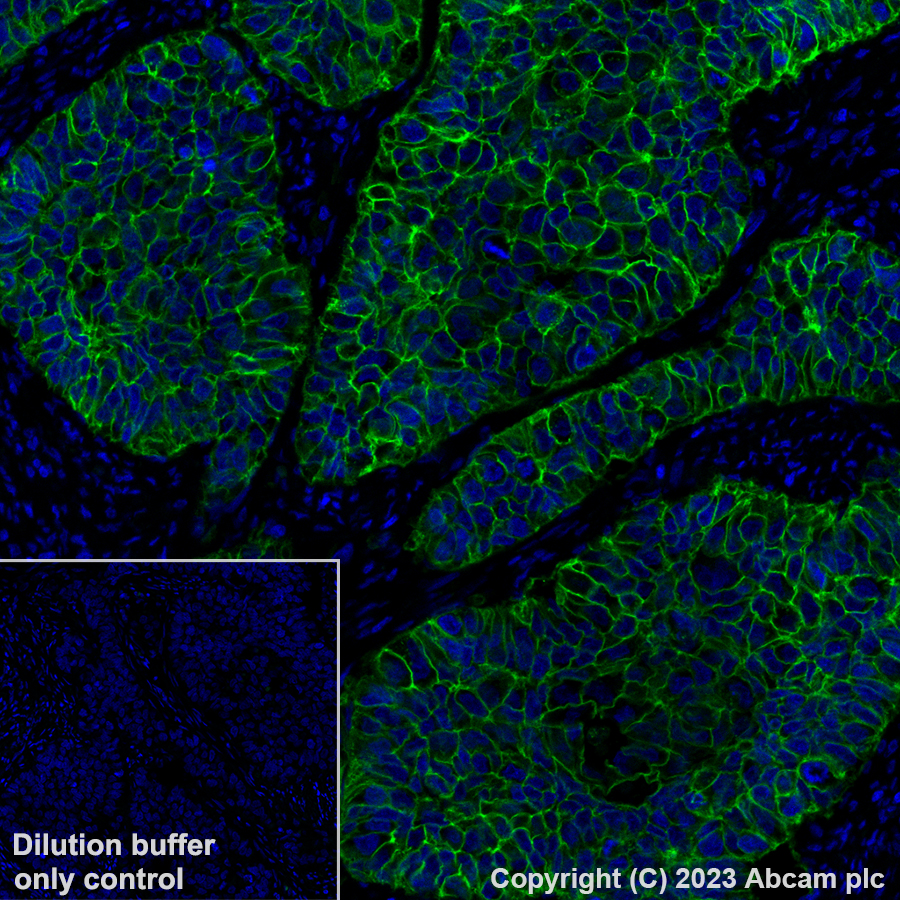 Immunohistochemistry (Formalin/PFA-fixed paraffin-embedded sections) - Alexa Fluor® 488 Anti-EpCAM antibody [EPR20532-222] (AB313667), expandable thumbnail