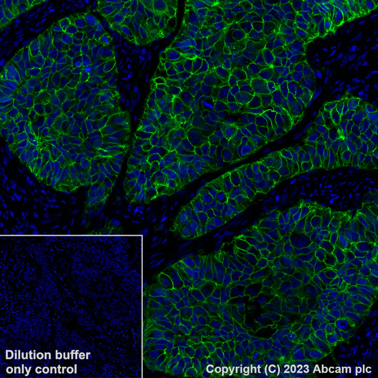 Immunohistochemistry (Formalin/PFA-fixed paraffin-embedded sections) - Alexa Fluor® 488 Anti-EpCAM antibody [EPR20532-222] (AB313667)
