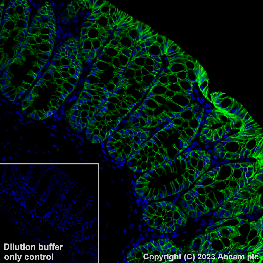 Immunohistochemistry (Formalin/PFA-fixed paraffin-embedded sections) - Alexa Fluor® 488 Anti-EpCAM antibody [EPR20532-222] (AB313667), expandable thumbnail