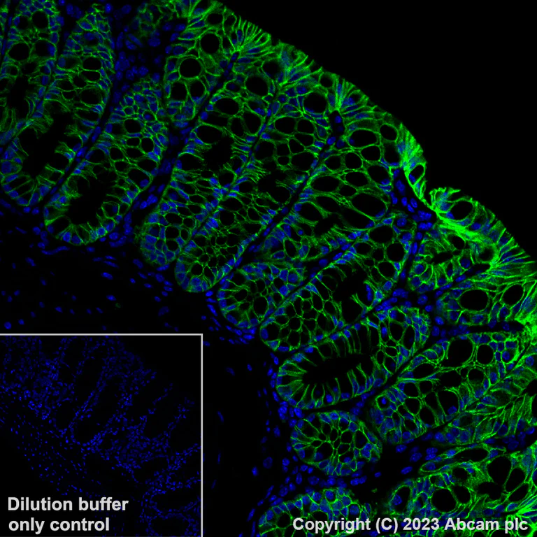 Immunohistochemistry (Formalin/PFA-fixed paraffin-embedded sections) - Alexa Fluor® 488 Anti-EpCAM antibody [EPR20532-222] (AB313667)