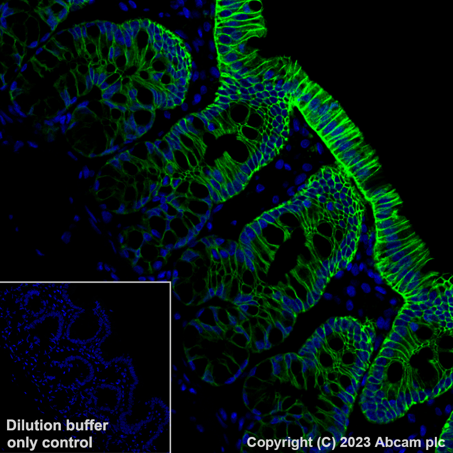 Immunohistochemistry (Formalin/PFA-fixed paraffin-embedded sections) - Alexa Fluor® 488 Anti-EpCAM antibody [EPR20532-222] (AB313667), expandable thumbnail