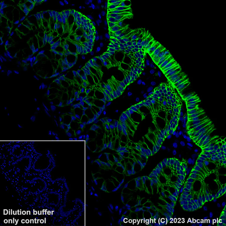 Immunohistochemistry (Formalin/PFA-fixed paraffin-embedded sections) - Alexa Fluor® 488 Anti-EpCAM antibody [EPR20532-222] (AB313667)