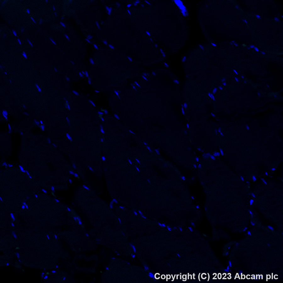 Immunohistochemistry (Formalin/PFA-fixed paraffin-embedded sections) - Alexa Fluor® 488 Anti-EpCAM antibody [EPR20532-222] (ab313667), expandable thumbnail