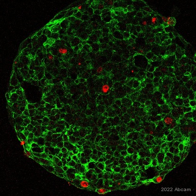 Alexa Fluor® 488 conjugated Anti-EpCAM antibody [EPR20532-225