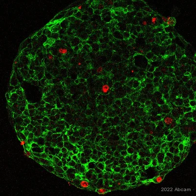 Immunocytochemistry/ Immunofluorescence - Alexa Fluor® 488 Anti-EpCAM antibody [EPR20532-225] (AB237395)