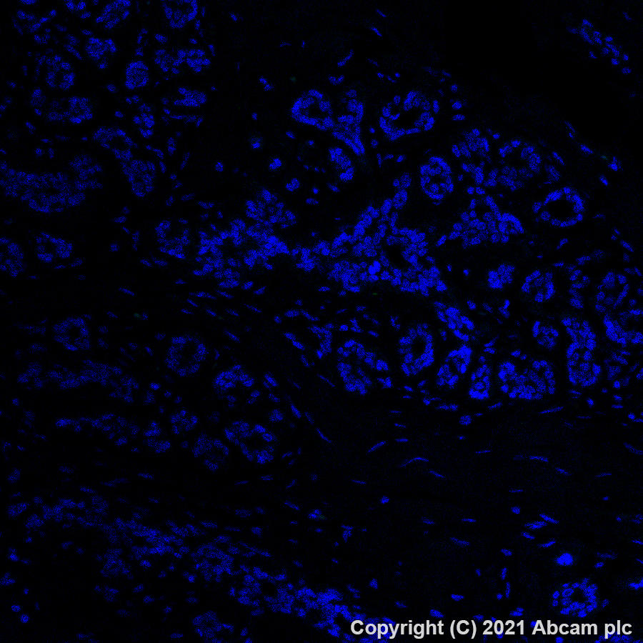 Immunohistochemistry (Formalin/PFA-fixed paraffin-embedded sections) - Alexa Fluor® 488 Anti-ErbB2 / HER2 antibody [EP1045Y] (AB275994), expandable thumbnail