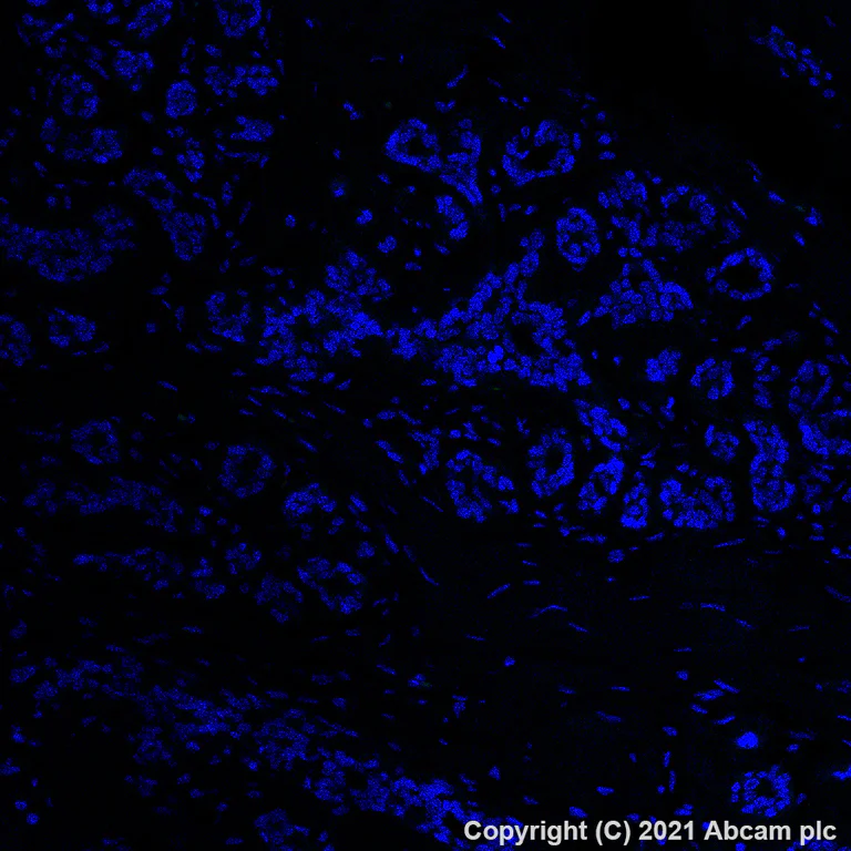 Immunohistochemistry (Formalin/PFA-fixed paraffin-embedded sections) - Alexa Fluor® 488 Anti-ErbB2 / HER2 antibody [EP1045Y] (AB275994)