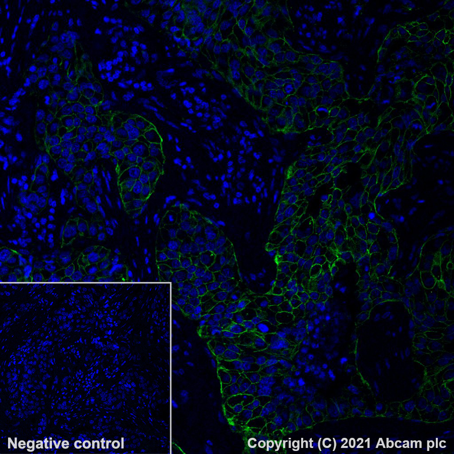 Immunohistochemistry (Formalin/PFA-fixed paraffin-embedded sections) - Alexa Fluor® 488 Anti-ErbB2 / HER2 antibody [EP1045Y] (AB275994), expandable thumbnail