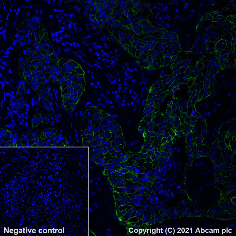Immunohistochemistry (Formalin/PFA-fixed paraffin-embedded sections) - Alexa Fluor® 488 Anti-ErbB2 / HER2 antibody [EP1045Y] (AB275994)