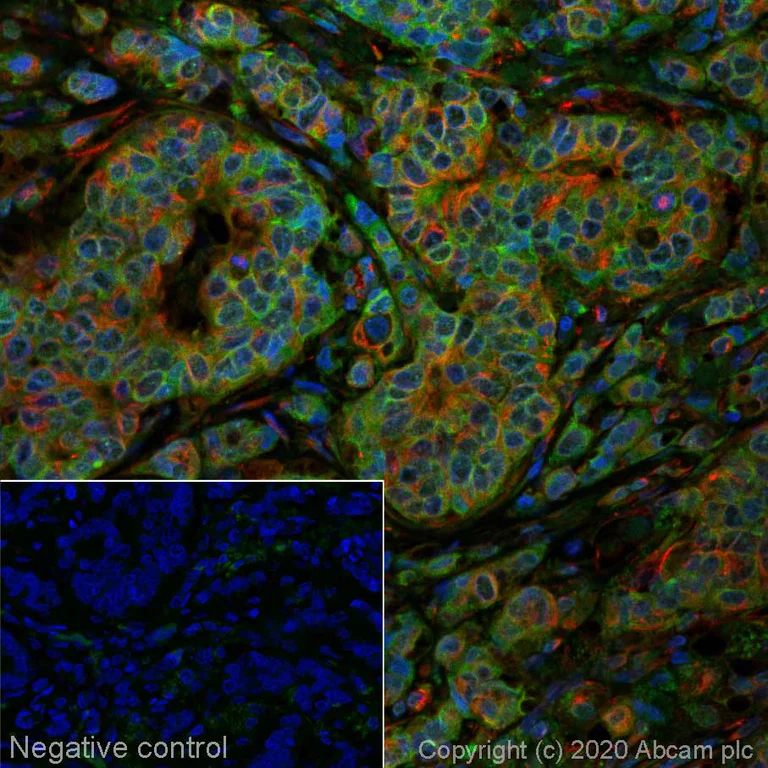 Immunohistochemistry (Formalin/PFA-fixed paraffin-embedded sections) - Alexa Fluor® 488 Anti-ErbB2 / HER2 antibody [SP3] (AB270190)