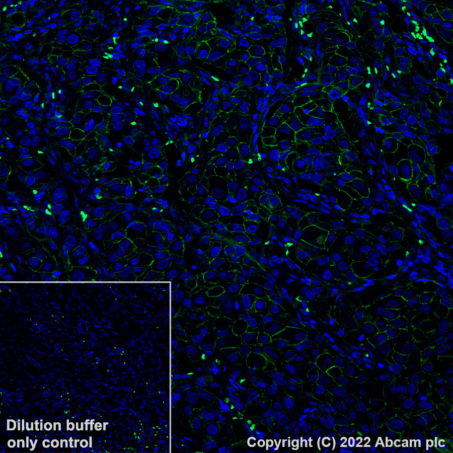 Immunohistochemistry (Formalin/PFA-fixed paraffin-embedded sections) - Alexa Fluor® 488 Anti-ErbB2 / HER2 + ErB4 / HER4 antibody [EPR22665-104] (AB305221), expandable thumbnail