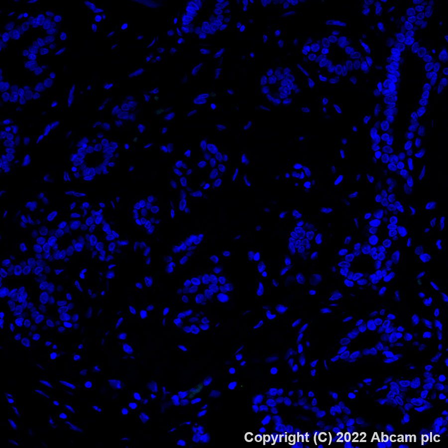 Immunohistochemistry (Formalin/PFA-fixed paraffin-embedded sections) - Alexa Fluor® 488 Anti-ErbB2 / HER2 + ErB4 / HER4 antibody [EPR22665-104] (AB305221), expandable thumbnail