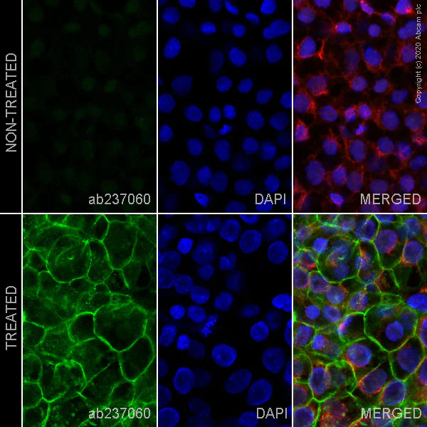 Immunocytochemistry/ Immunofluorescence - Alexa Fluor® 488 Anti-ErbB2 / HER2 (phospho Y877) antibody [EP2324Y] (AB237060)