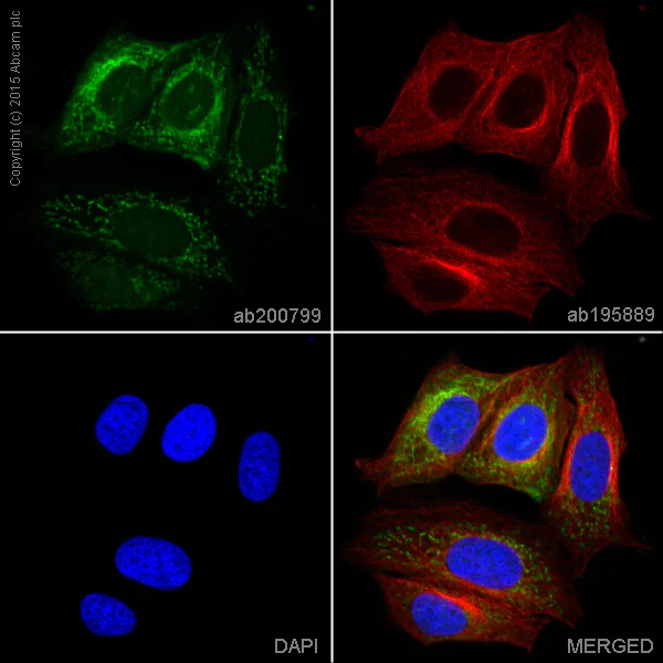 Immunocytochemistry/ Immunofluorescence - Alexa Fluor® 488 Anti-Estrogen Inducible Protein pS2 antibody [EPR3972] (AB200799)