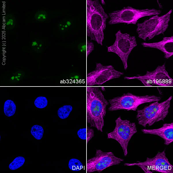 Immunocytochemistry/ Immunofluorescence - Alexa Fluor® 488 Anti-EXOSC10/RRP6 antibody [EPR28902-62] (AB324365)