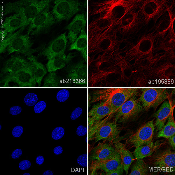 Alexa Fluor® 488 Anti-FABP4 antibody [EPR3579] (ab216366) | Abcam