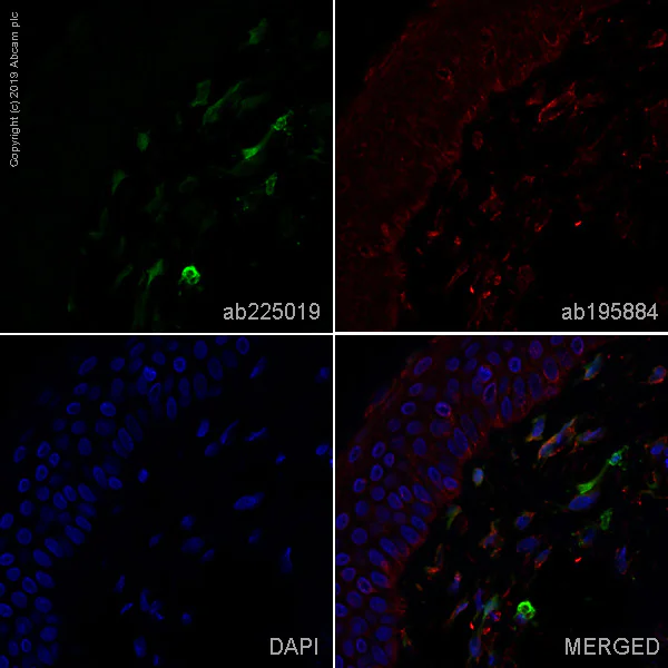 Immunohistochemistry (Formalin/PFA-fixed paraffin-embedded sections) - Alexa Fluor® 488 Anti-Factor XIIIa antibody [EP3372] (AB225019)