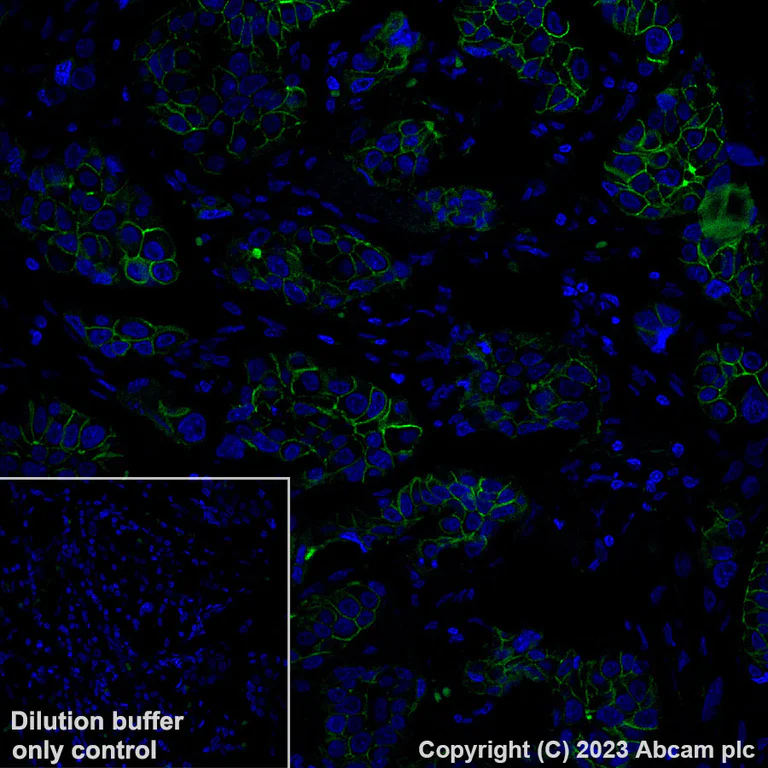 Immunohistochemistry (Formalin/PFA-fixed paraffin-embedded sections) - Alexa Fluor® 488 Anti-FGFR2 antibody [EPR24075-418] (AB309606)