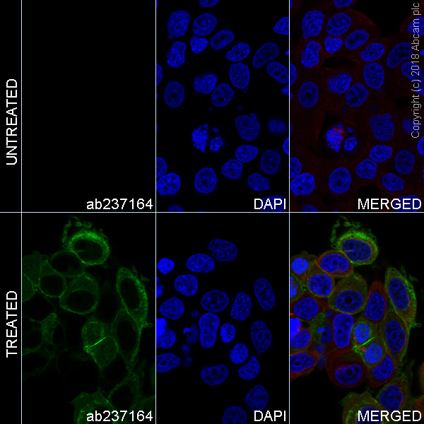 Immunocytochemistry/ Immunofluorescence - Alexa Fluor® 488 Anti-FGFR3 (phospho Y724) antibody [EPR2281(3)] (AB237164)