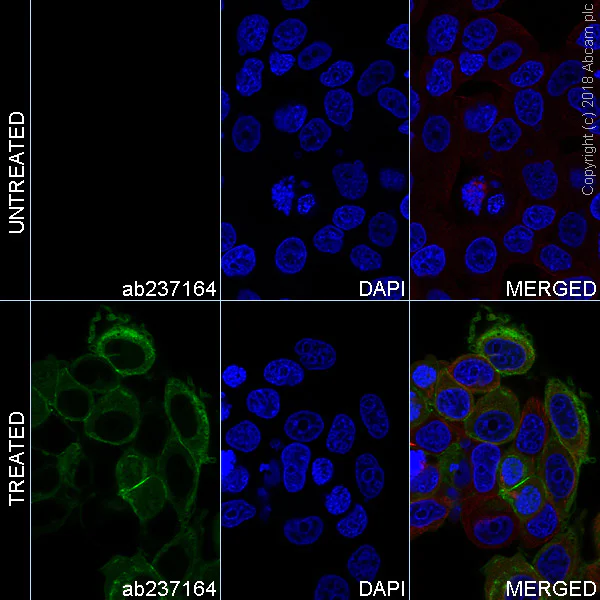 Immunocytochemistry/ Immunofluorescence - Alexa Fluor® 488 Anti-FGFR3 (phospho Y724) antibody [EPR2281(3)] (AB237164)