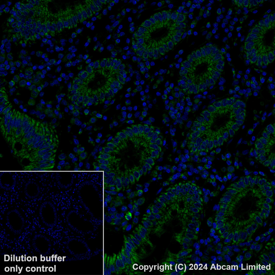 Immunohistochemistry (Formalin/PFA-fixed paraffin-embedded sections) - Alexa Fluor® 488 Anti-FH/Fumarase antibody [EPR21104] (AB320700), expandable thumbnail