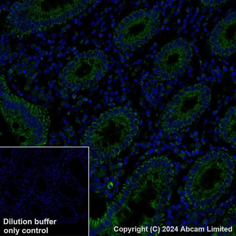 Immunohistochemistry (Formalin/PFA-fixed paraffin-embedded sections) - Alexa Fluor® 488 Anti-FH/Fumarase antibody [EPR21104] (AB320700)
