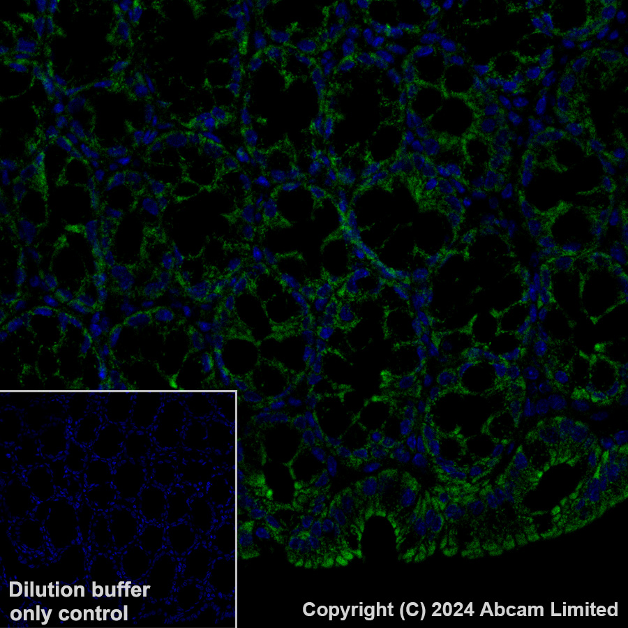 Immunohistochemistry (Formalin/PFA-fixed paraffin-embedded sections) - Alexa Fluor® 488 Anti-FH/Fumarase antibody [EPR21104] (AB320700), expandable thumbnail