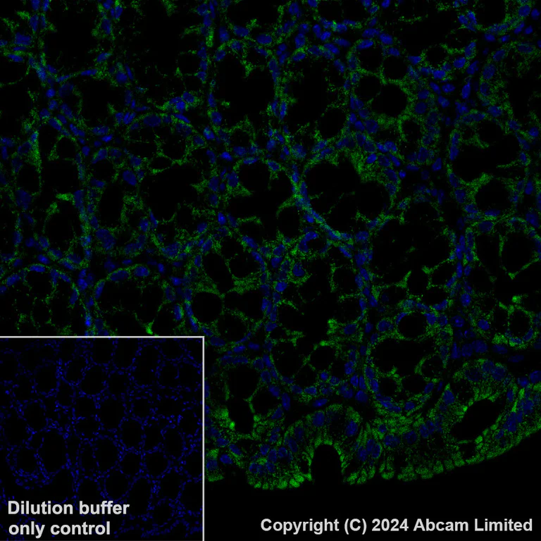 Immunohistochemistry (Formalin/PFA-fixed paraffin-embedded sections) - Alexa Fluor® 488 Anti-FH/Fumarase antibody [EPR21104] (AB320700)