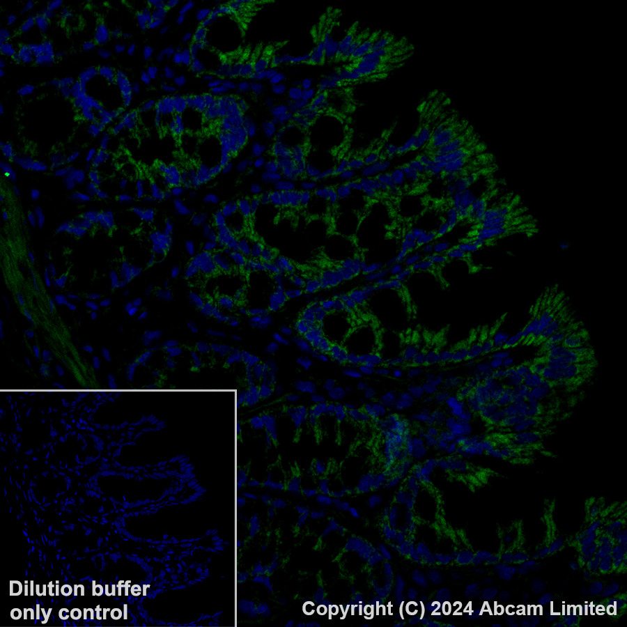Immunohistochemistry (Formalin/PFA-fixed paraffin-embedded sections) - Alexa Fluor® 488 Anti-FH/Fumarase antibody [EPR21104] (AB320700), expandable thumbnail
