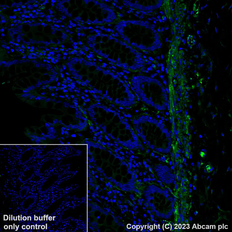 Immunohistochemistry (Formalin/PFA-fixed paraffin-embedded sections) - Alexa Fluor® 488 Anti-Fibronectin antibody [EPR23110-46] (AB314679)